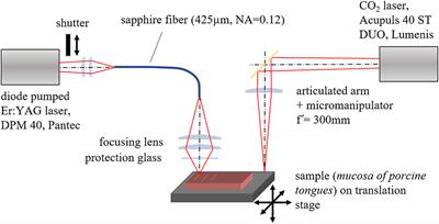 Comparative ex vivo Investigations on the Cutting Quality of the CO2 Laser and the Diode Pumped Er:YAG Laser